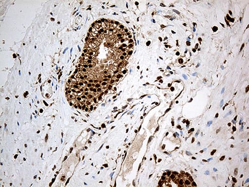 CDK15 / ALS2CR7 Antibody (aa293-378, clone OTI3B9)