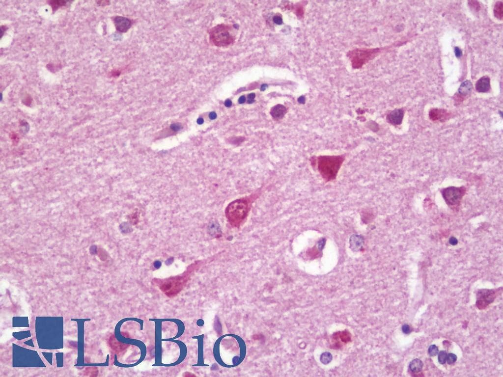 RPL27 / Ribosomal Protein L27 Antibody (HRP)
