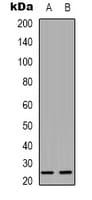 CKLFSF4 / CMTM4 Antibody (Internal)