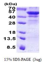 Human HEXA Protein (Recombinant His)