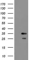 RBPMS / Hermes Antibody (clone OTI1C11)