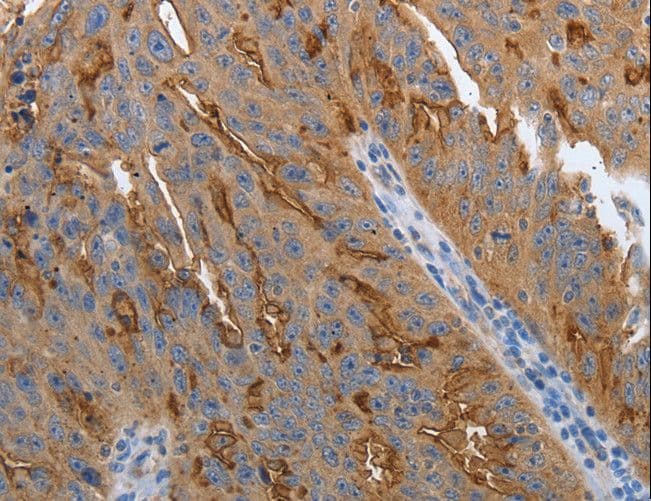 IHC-plus™ SLC34A2 / NaPi-2b Antibody (C-Terminus)