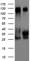 Monoclonal Mouse anti-Human TRIM24 / TIF1 Antibody (clone OTI2D9, aa706-1016, IHC, WB)