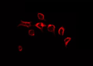 HNRNPA2B1 Antibody