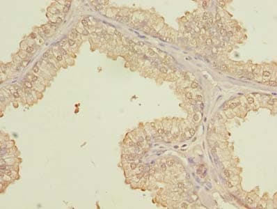 PQLC3 Antibody