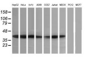 MAP2K3 / MEK3 / MKK3 Antibody (clone OTI5D3, Carrier-free)