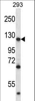Polyclonal Rabbit anti-Human MATR3 / Matrin 3 Antibody (aa157-186, WB)