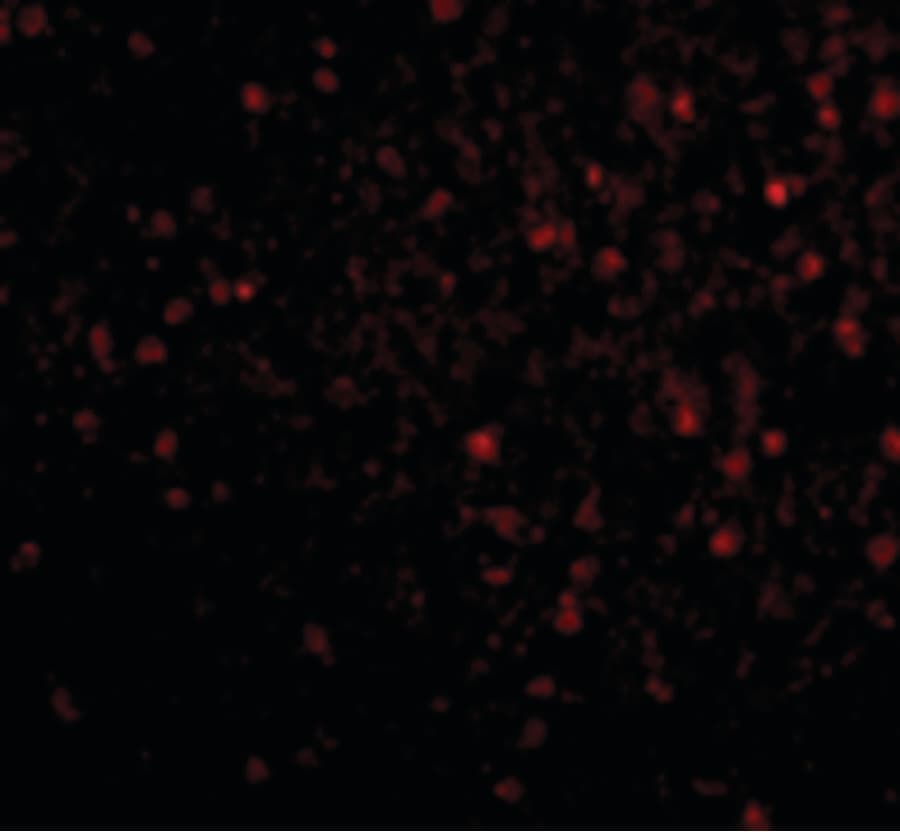 Polyclonal Rabbit anti-Human BRSK2 Antibody (IHC, IF, WB)