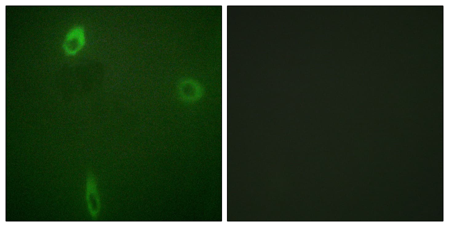 KCNJ1 / ROMK Antibody (phospho-Ser44/Ser25)