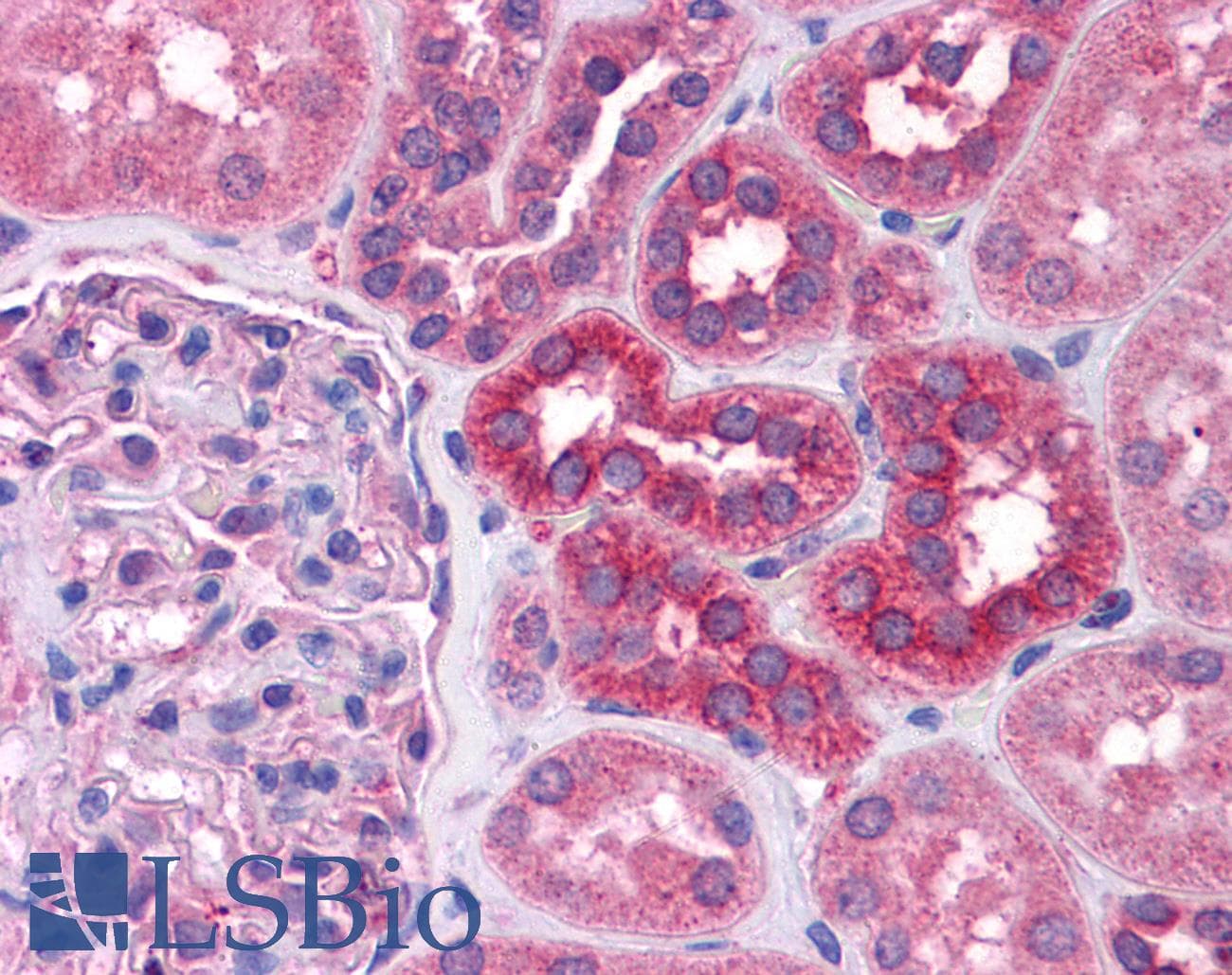 Polyclonal Rabbit anti-Human STAT6 Antibody (aa614-663, IHC, WB)