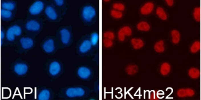 Polyclonal Rabbit anti-Human Histone H3 Antibody (Di-Methyl-Lys4, IHC, IF, WB)