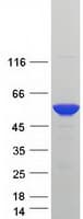 Human RILPL1 Protein (Recombinant Myc-DDK (Flag))