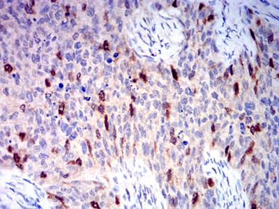 AURKA / Aurora-A Antibody (aa268-404, clone 2D8A4)