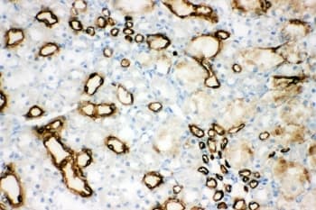 AQP1 / Aquaporin 1 Antibody (aa251-269)