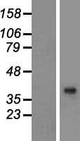 BHMT2 Protein (Over-Expression Lysate Myc-DDK (Flag))