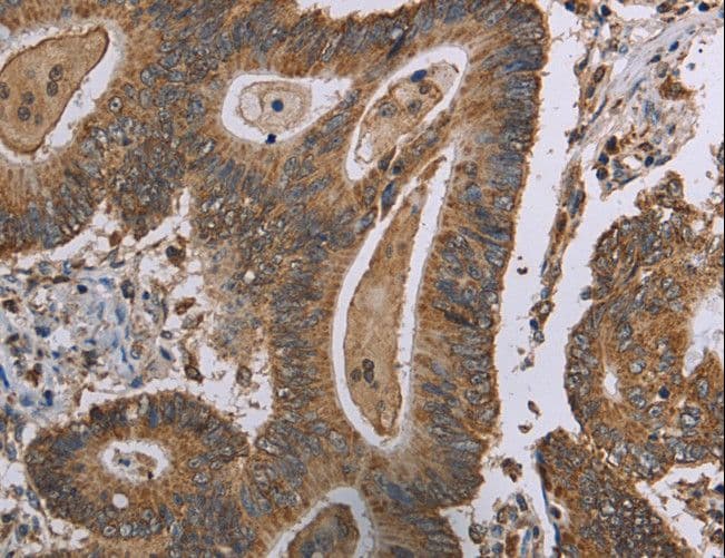 MRGX1 / MRGPRX1 Antibody