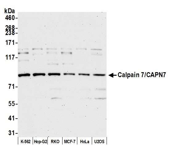 CAPN7 / Calpain 7 Antibody (aa50-100)