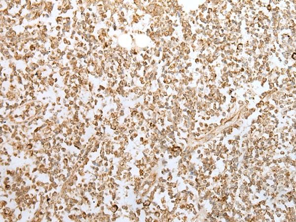 ZKSCAN1 / ZNF36 Antibody