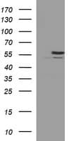 TUBB2B / Tubulin Beta 2B Antibody (clone OTI8F12)