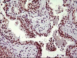 UPRT Antibody (clone OTI2D10)
