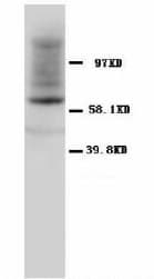 HSPD1 / HSP60 Antibody (Internal)