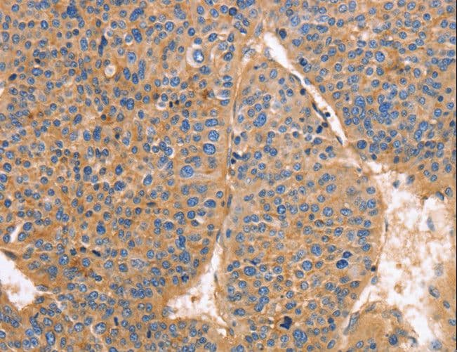 GNB1 Antibody