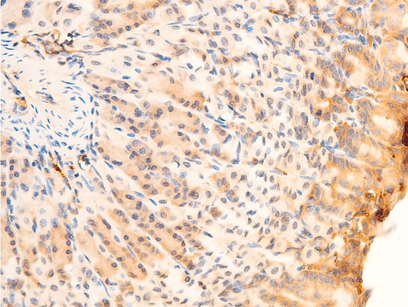 Polyclonal Rabbit anti-Human SYK Antibody (phospho-Tyr323, IHC, IF, WB)