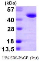 Human FARS2 Protein (Recombinant His)