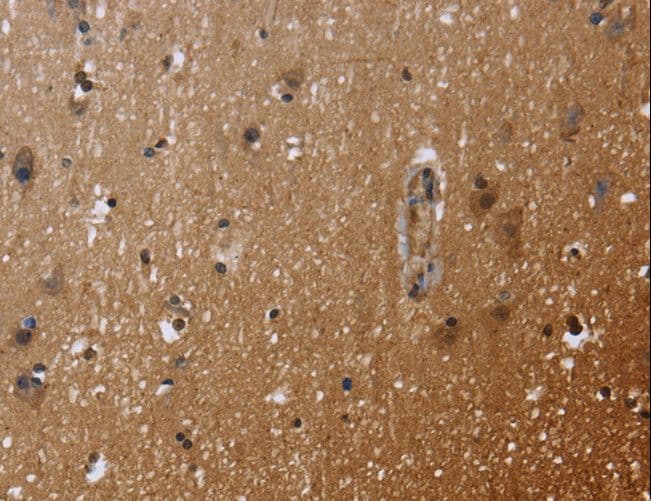 FHL3 Antibody