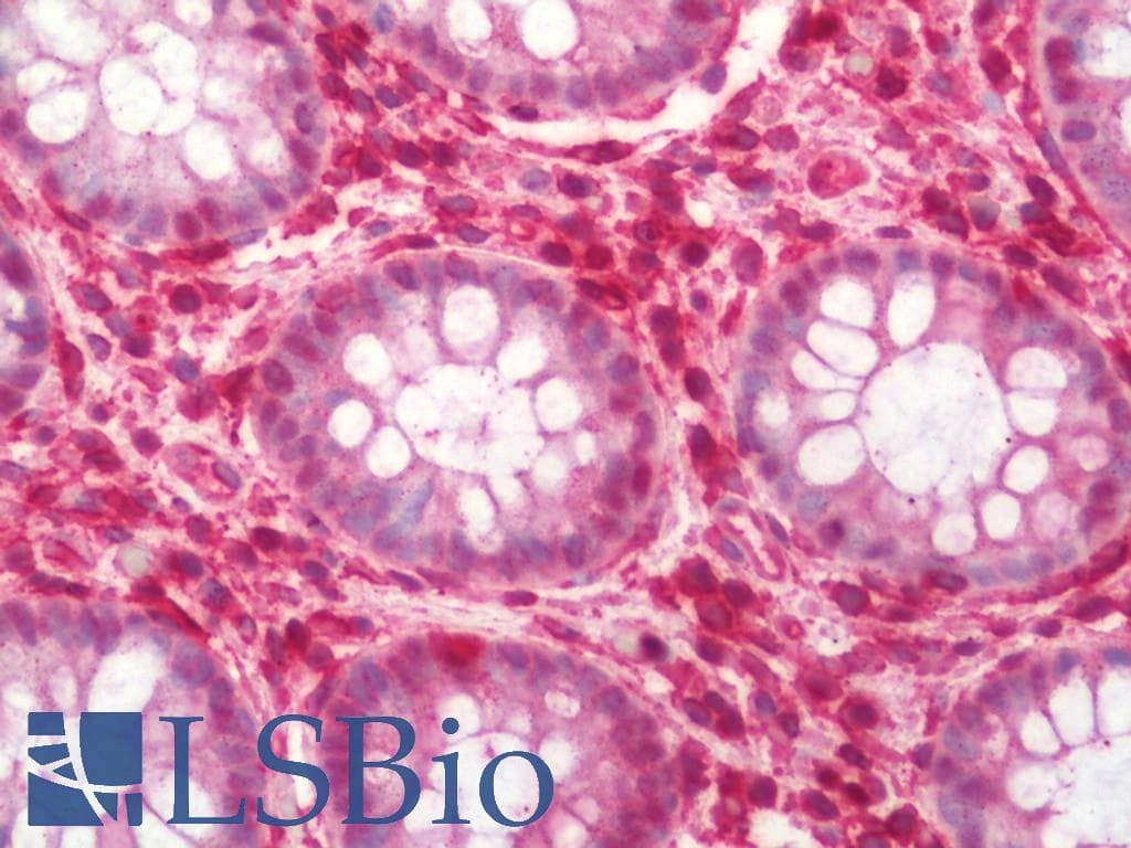 ANXA5 / Annexin V Antibody (FITC)