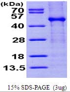 Human FKBPL Protein (Recombinant His)