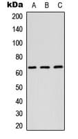 Polyclonal Rabbit anti-Human RAB11FIP1 Antibody (aa109-148, IHC, WB)
