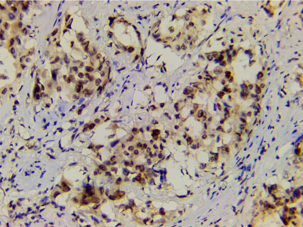 LIMK1 / LIMK Antibody (phospho-Thr508)