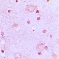SFRS7 / 9G8 Antibody (Internal)