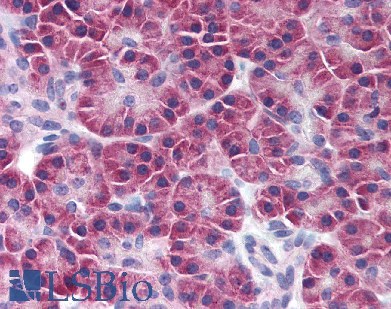 IHC-plus™ SIK2 / SNF1LK2 Antibody (clone S15G10)