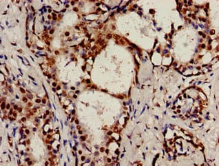 Polyclonal Rabbit anti-Human RAD9A / RAD9 Antibody (IHC)