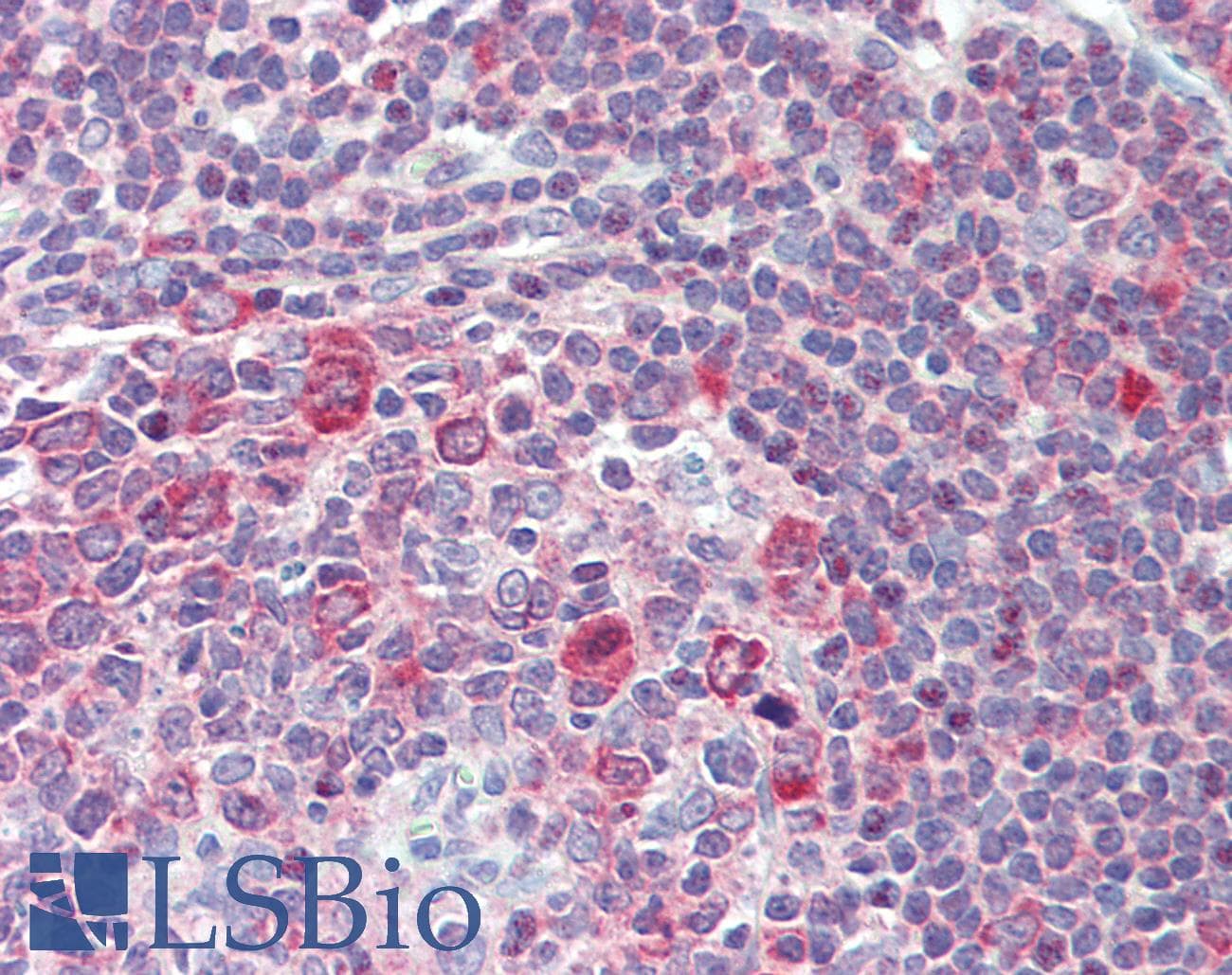 IHC-plus™ Polyclonal Rabbit anti-Human GART / GARS Antibody (aa200-250, IHC, WB)