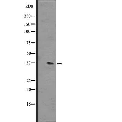 Polyclonal Rabbit anti-Human OR51L1 Antibody (IHC, WB)