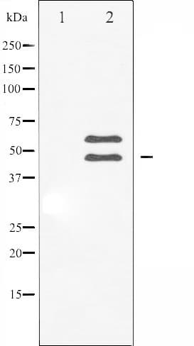 CAMK2B / CaMKII Beta Antibody