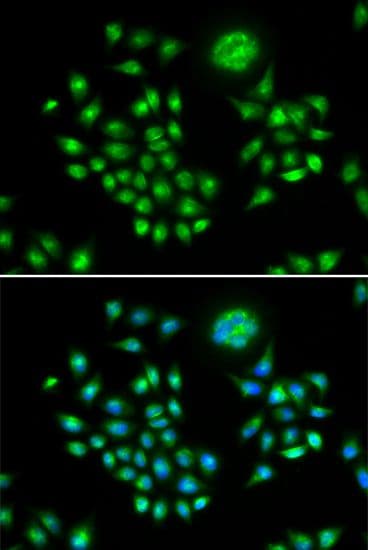 Polyclonal Rabbit anti-Human AGFG1 Antibody (IF, WB)