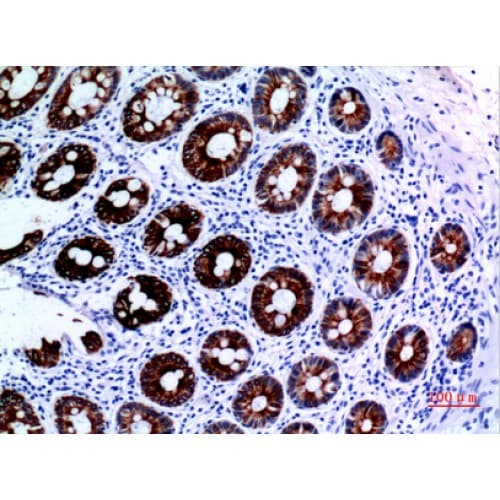 Polyclonal Rabbit anti-Human KRT8 / CK8 / Cytokeratin 8 Antibody (IHC, WB)
