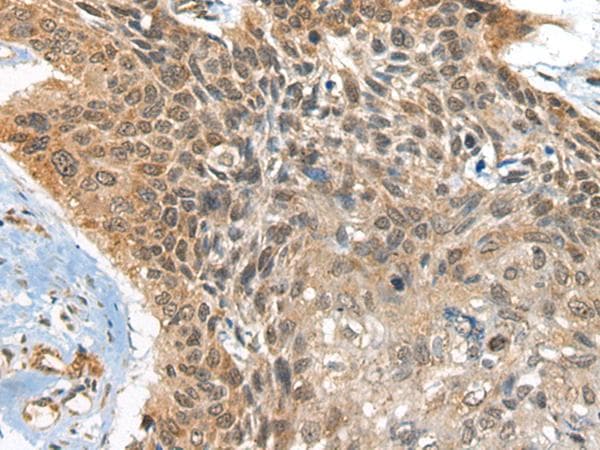 Polyclonal Rabbit anti-Human BOLA1 Antibody (IHC)