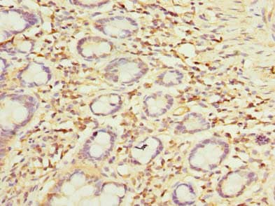 OTUD6B Antibody