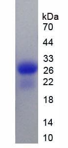 Rat CALB1 / Calbindin Protein (Recombinant His)