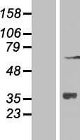 ZNF286A Protein (Over-Expression Lysate Myc-DDK (Flag))