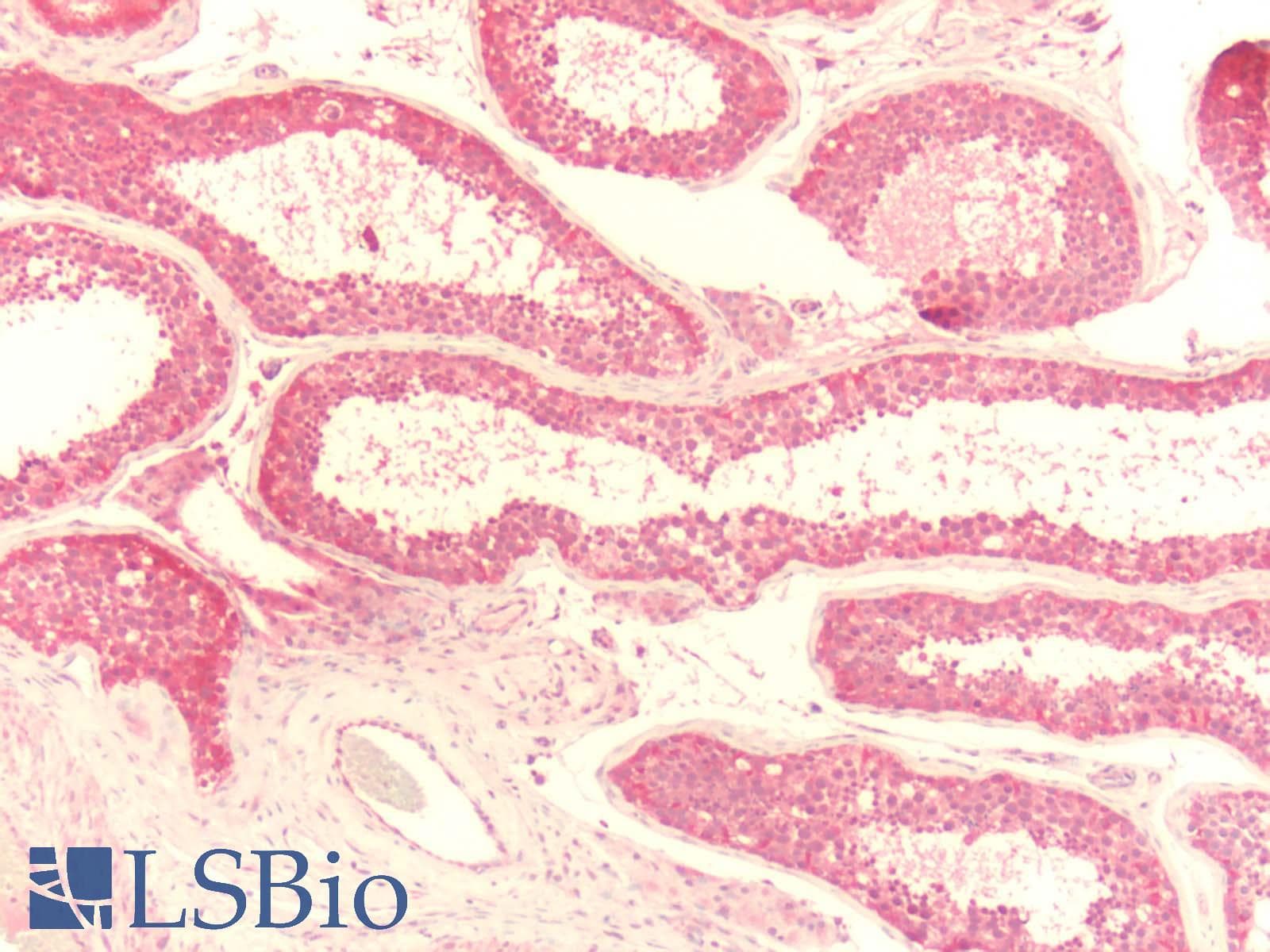 IHC-plus™ Polyclonal Rabbit anti-Human ADGRE1 / EMR1 Antibody (C-Terminus, IHC)