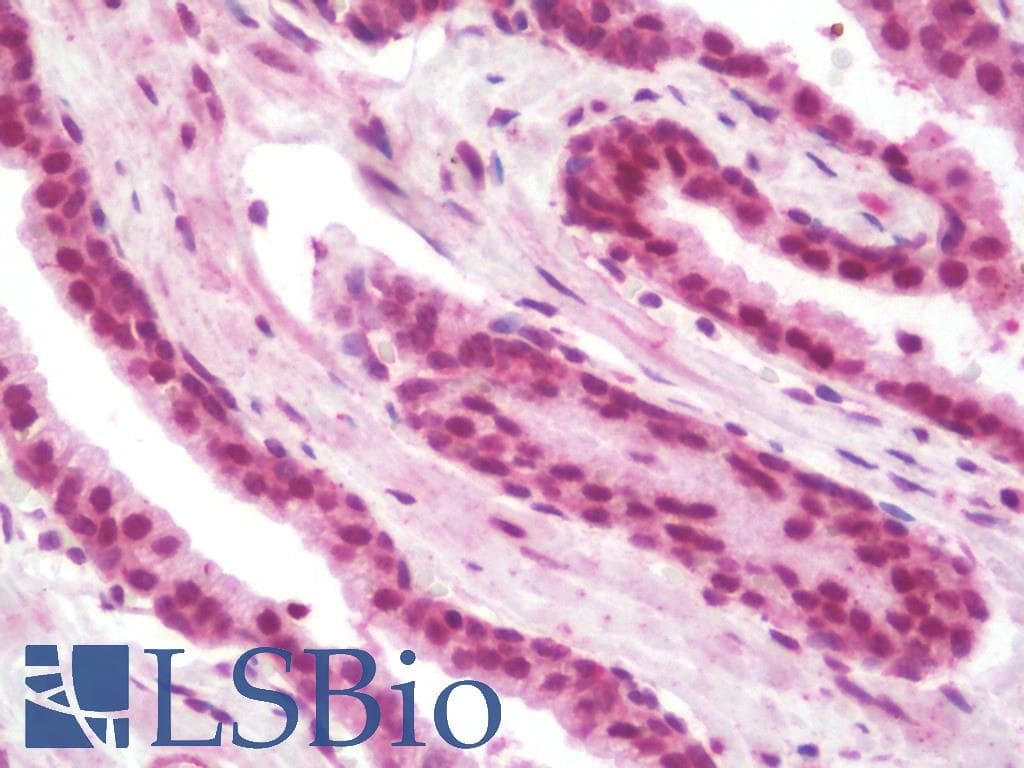 IHC-plus™ Polyclonal Rabbit anti-Human PHF14 Antibody (IHC, IF, WB)
