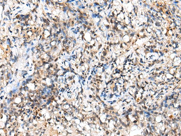 NUDT18 Antibody