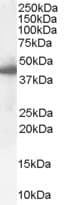 IHC-plus™ SERPINE1 / PAI-1 Antibody (aa71-85)