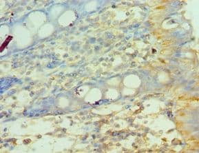Polyclonal Rabbit anti-Human MMP14 Antibody (aa260-540, IHC)